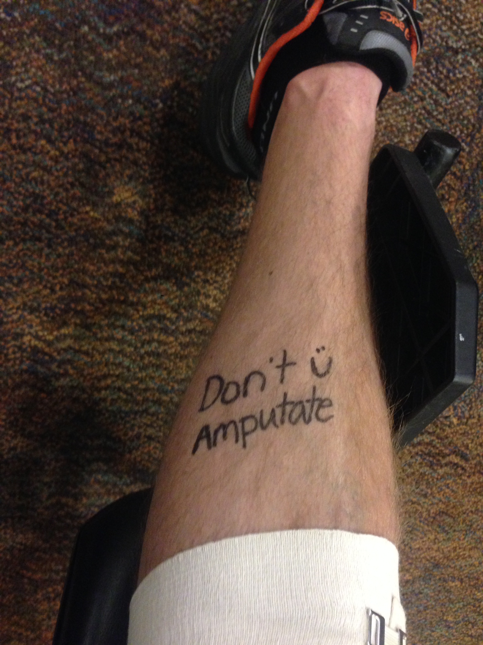Don't Amputate